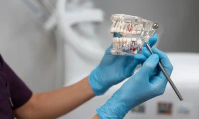 dentista guantes muestra posicion muela del juicio