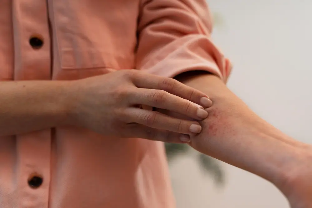 hombre se rasca una herida que pica