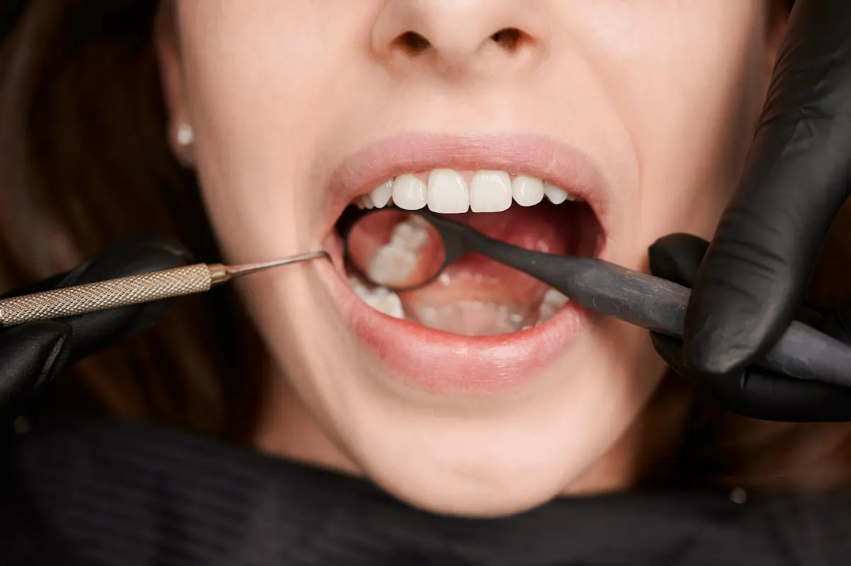 chica con boca abierta visita dentista