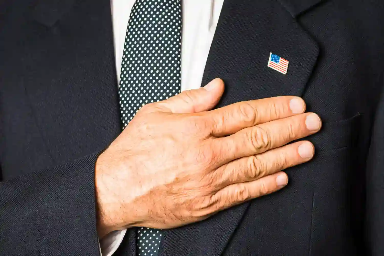 las manos con hematomas de Donald Trump