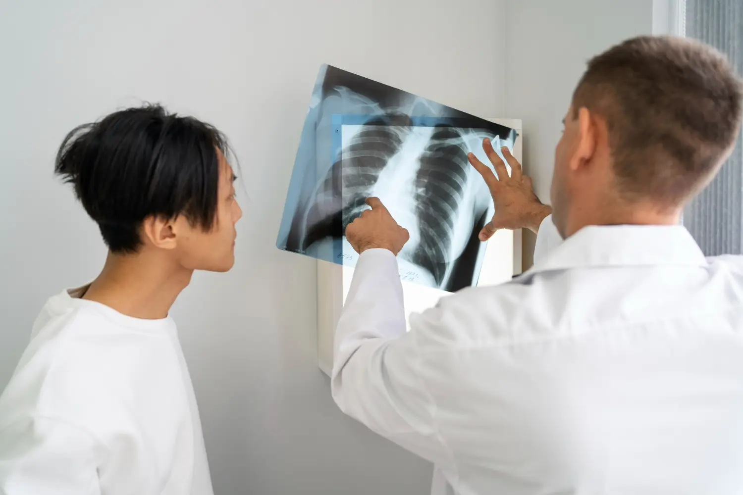 se puede vivir con fibrosis pulmonar