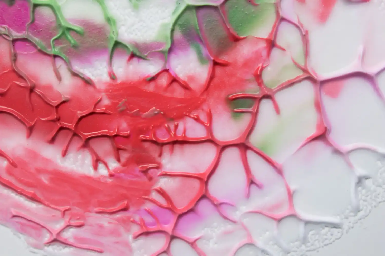 Células madre tras infarto