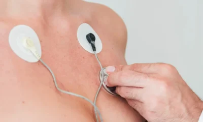 paciente con una electromiografía