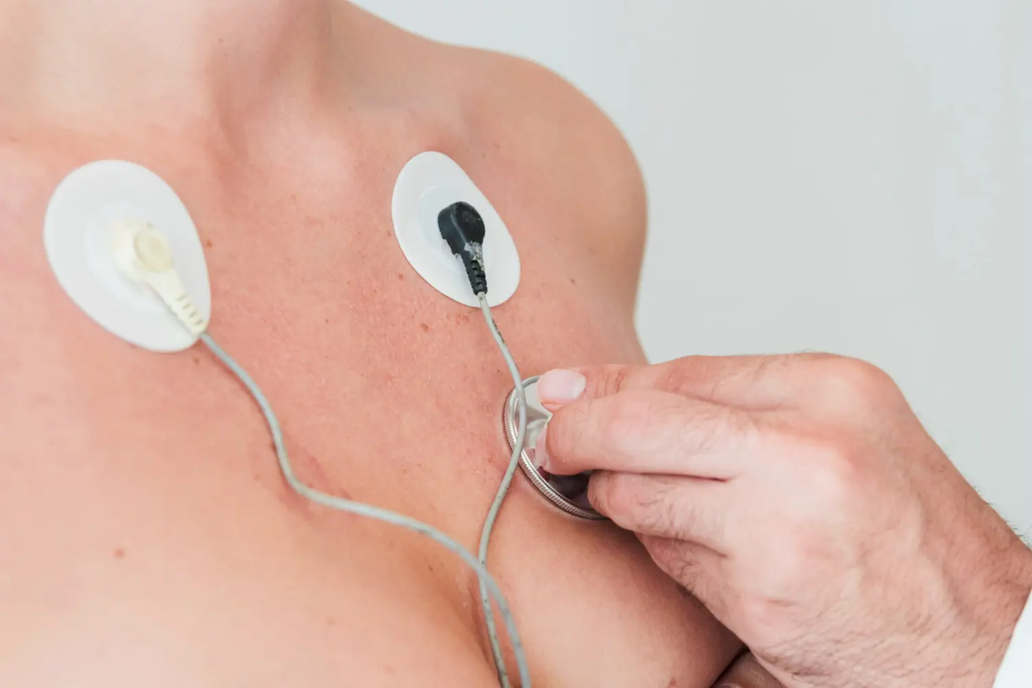 paciente con una electromiografía