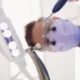 cuanto dura una endodoncia