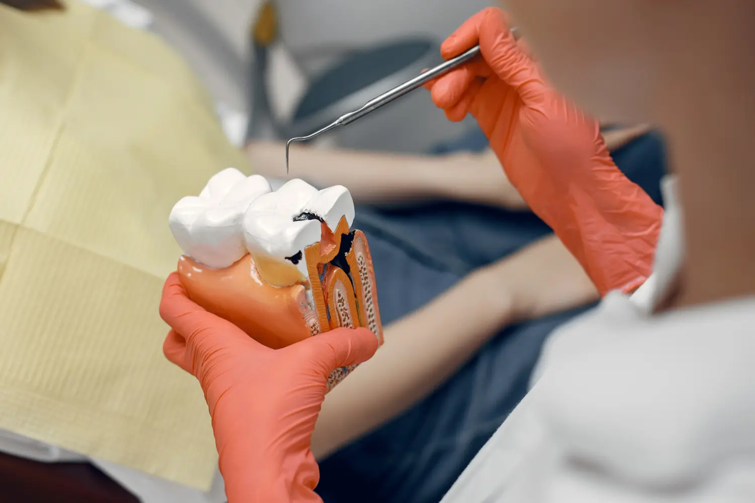 endodoncia que es