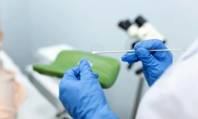 motivos por los que sale una citologia alterada