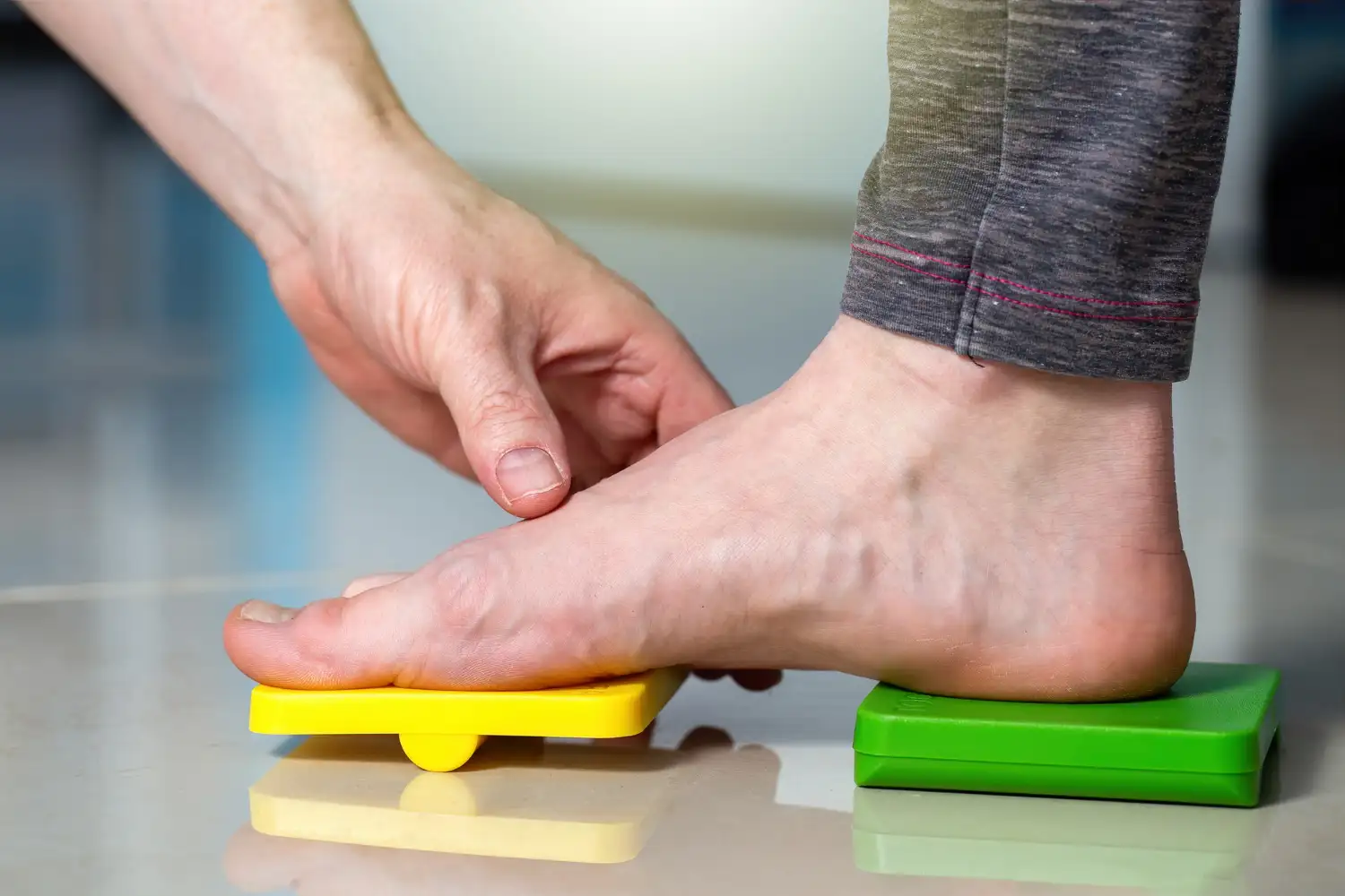 qué es la fascitis plantar guia completa