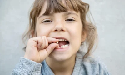 se pueden caer los dientes a los 5 años