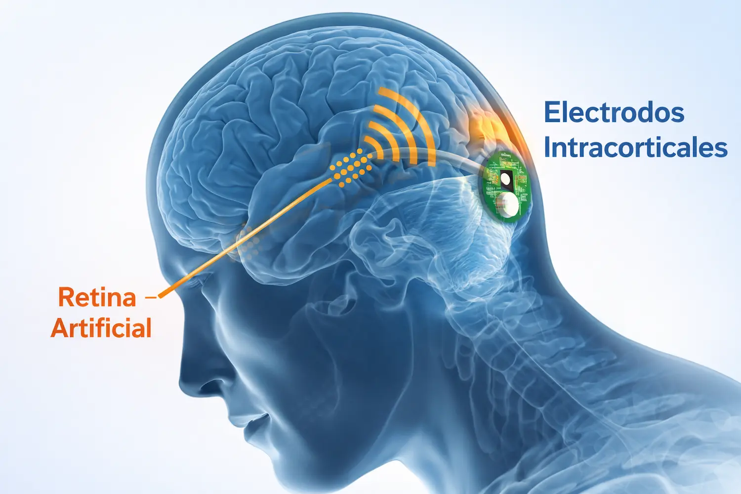 implante cerebral devolvió visión a un ciego