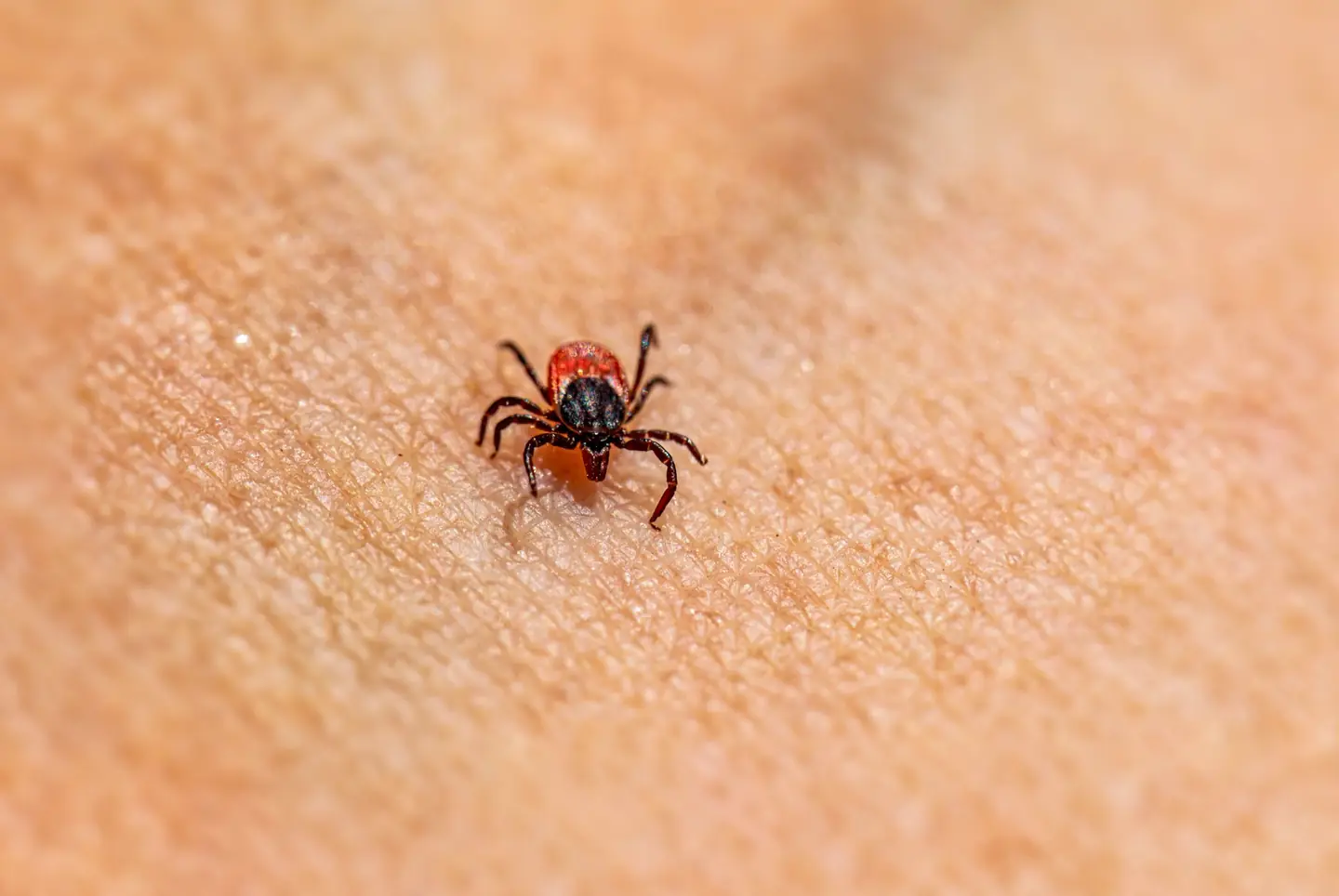 garrapatas en España durante el verano en la piel de una persona tras una salida al aire libre