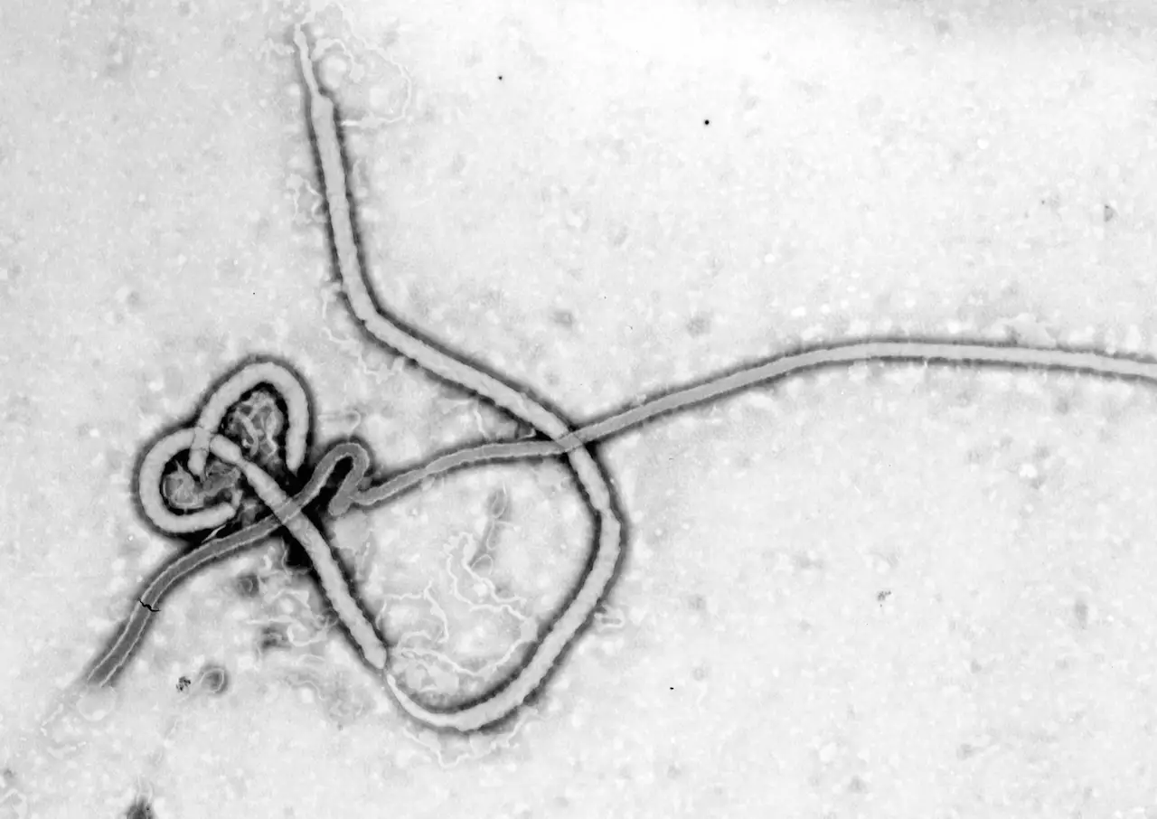 enfermedad por el virus del ébola