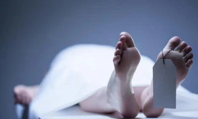 cadaver humano en la morgue