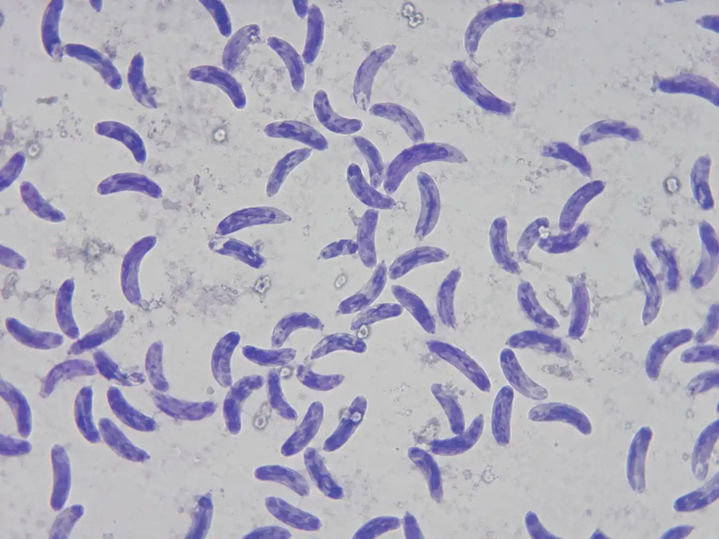 la bacteria come carne