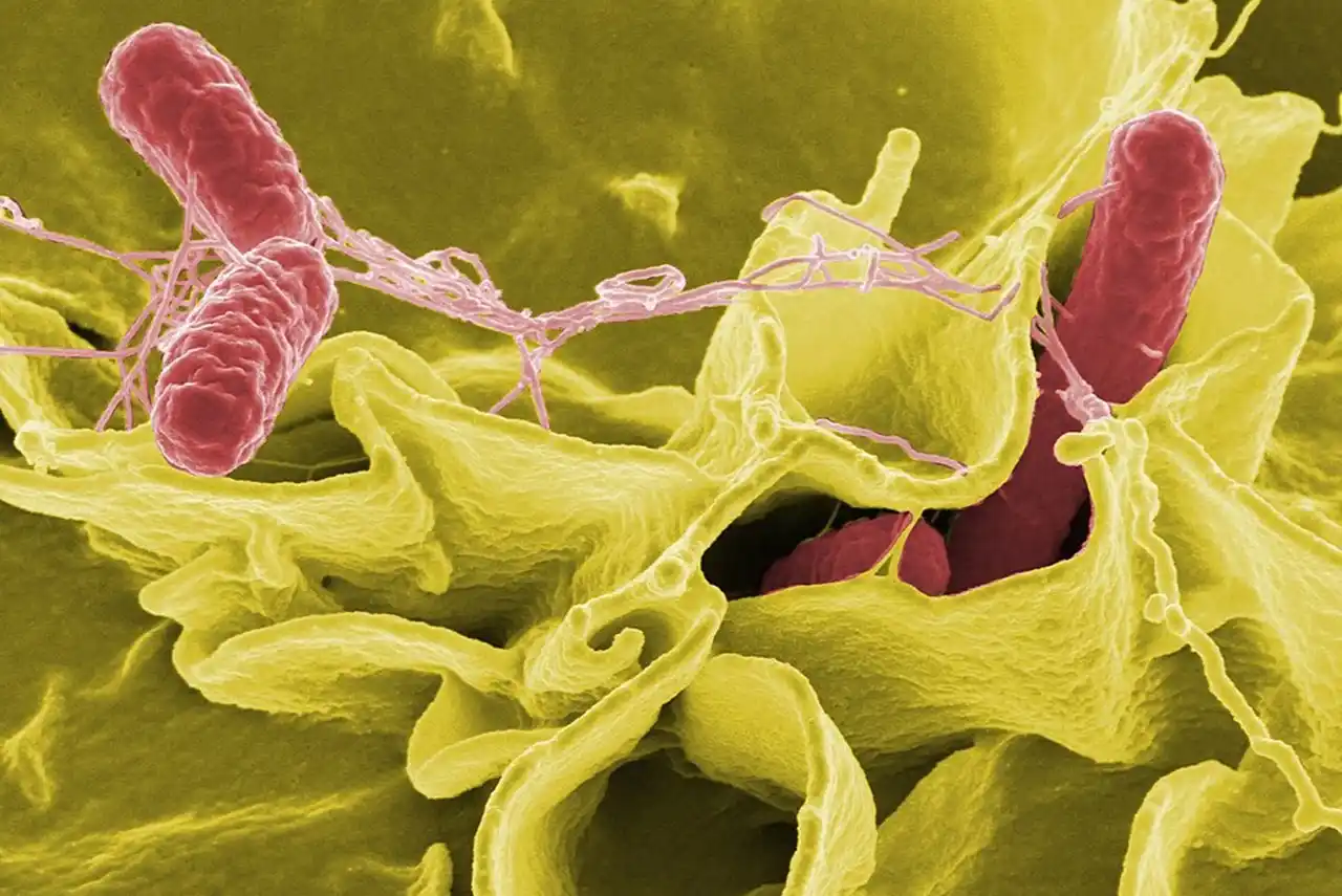 salmonelosis
