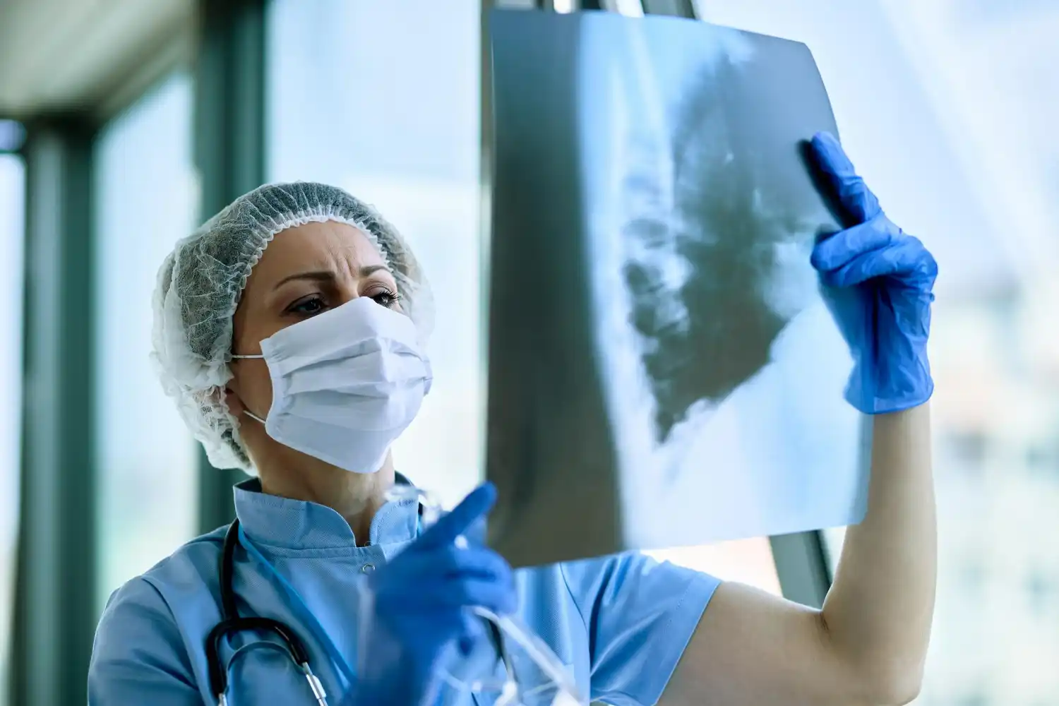 tuberculosis en Segovia