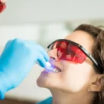 ¿Qué blanqueadores dentales retira AEMPS y qué lotes están afectados?