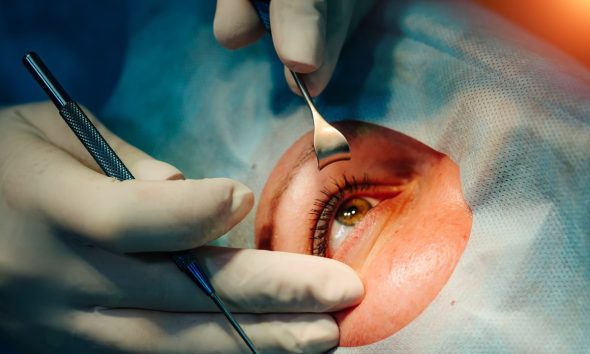 Corrección láser para visión. Cirugía oftalmológica para ojo — Felipe VI, operado de cataratas a los 58: qué es y por qué es la cirugía ocular más común